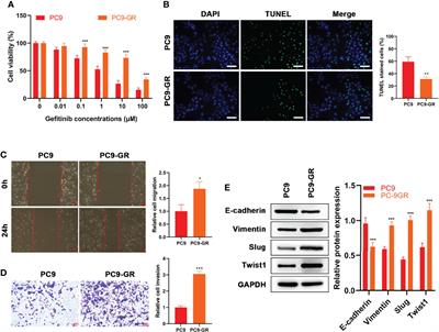 Sensitization of Non-Small Cell Lung Cancer Cells to Gefitinib and Reversal of Epithelial–Mesenchymal Transition by Aloe-Emodin Via PI3K/Akt/TWIS1 Signal Blockage